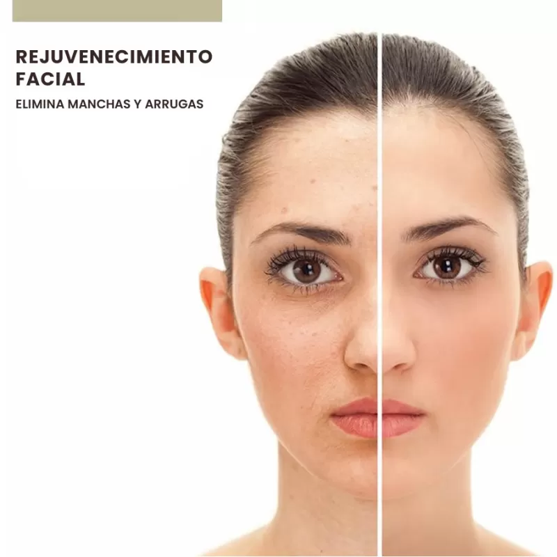 Tratamientos faciales - FISIOMEDIC | Kinesiólogo en Puerto Montt